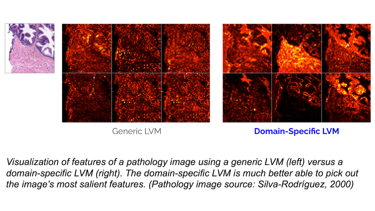 Visualization of features of a pathology image using a generic LVM (left) versus a domain-specific LVM (right)